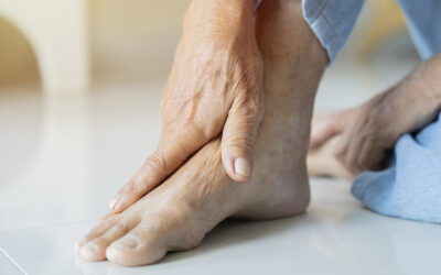 Bruciore alle gambe dal ginocchio in giù: quando il montascale può essere utile